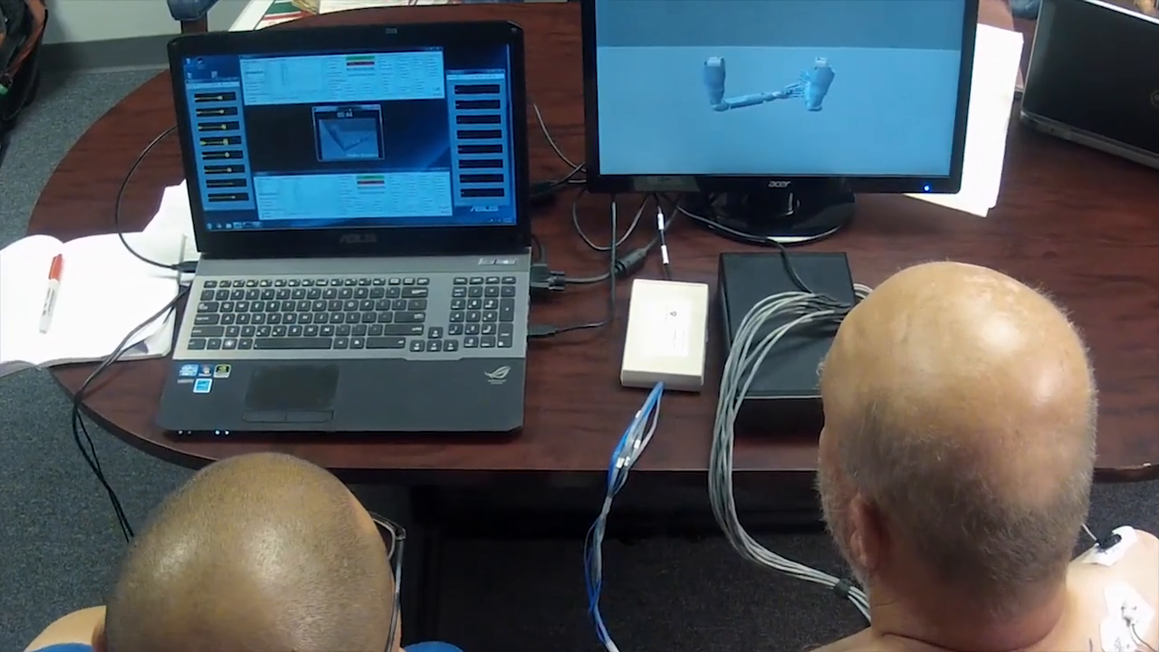 The patient is hooked up to chest electrodes while watching a laptop screen displaying a 3D model of two arms. -
