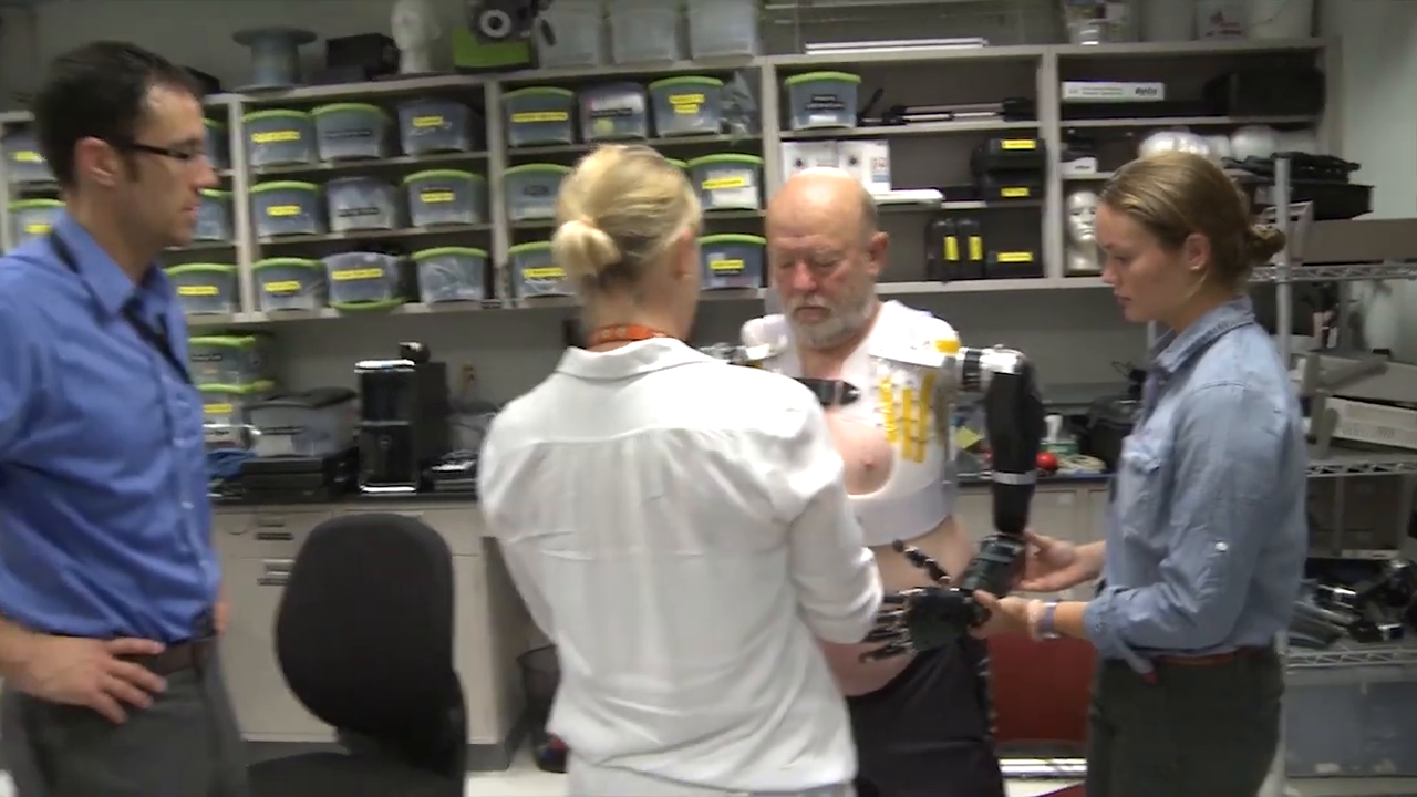 The engineering team physically attaches the robotic arm to the mounting point on the patient's custom chest harness. -